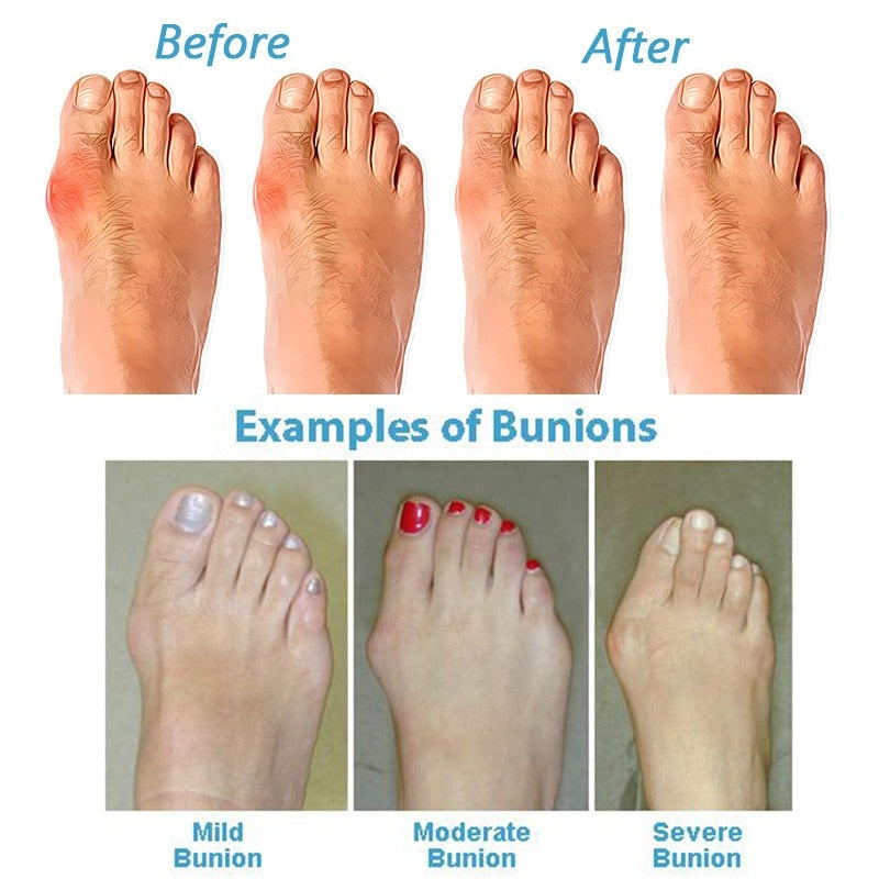Comfortable Orthopaedic Sandals | Myna